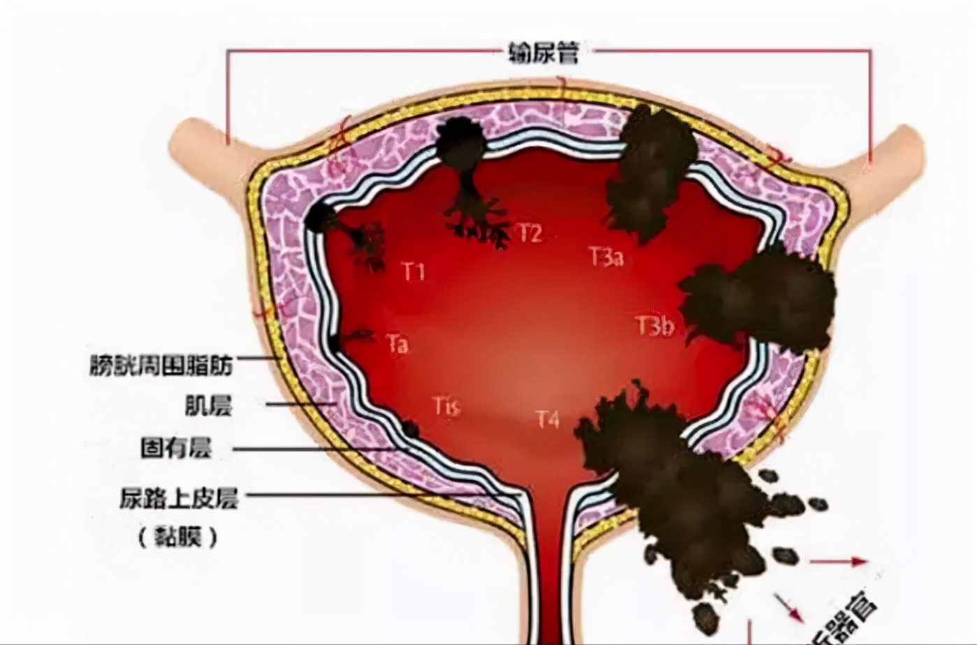 尿急是什么意思啊,尿急是什么意思流行用语