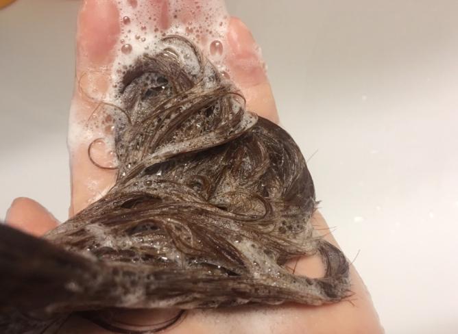 头皮长了个疙瘩破了怎么办,头皮为啥老长粉刺之类的疙瘩