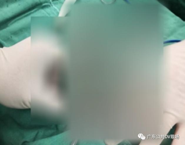 拖不起！男孩突然“蛋疼”不止，隔天送医被切除