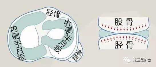 半月板受伤的理由,半月板最怕的动作别再做了