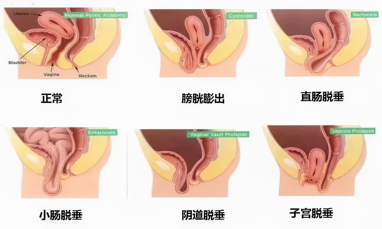 写了六年科普文,竟挡不住弟媳加入微商卖缩阴