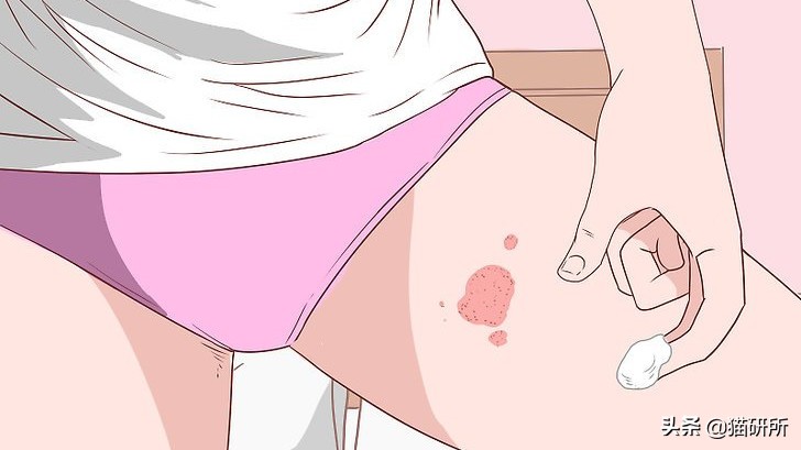 猫癣最全的药物治疗方法,如何快速的治愈猫癣