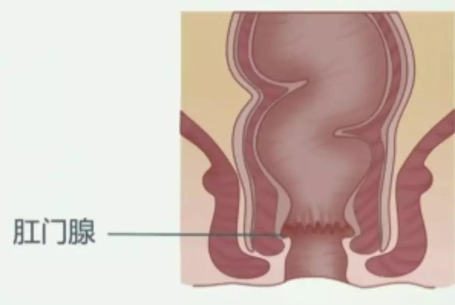 屁股痤疮最怕的克星,屁股痛的克星