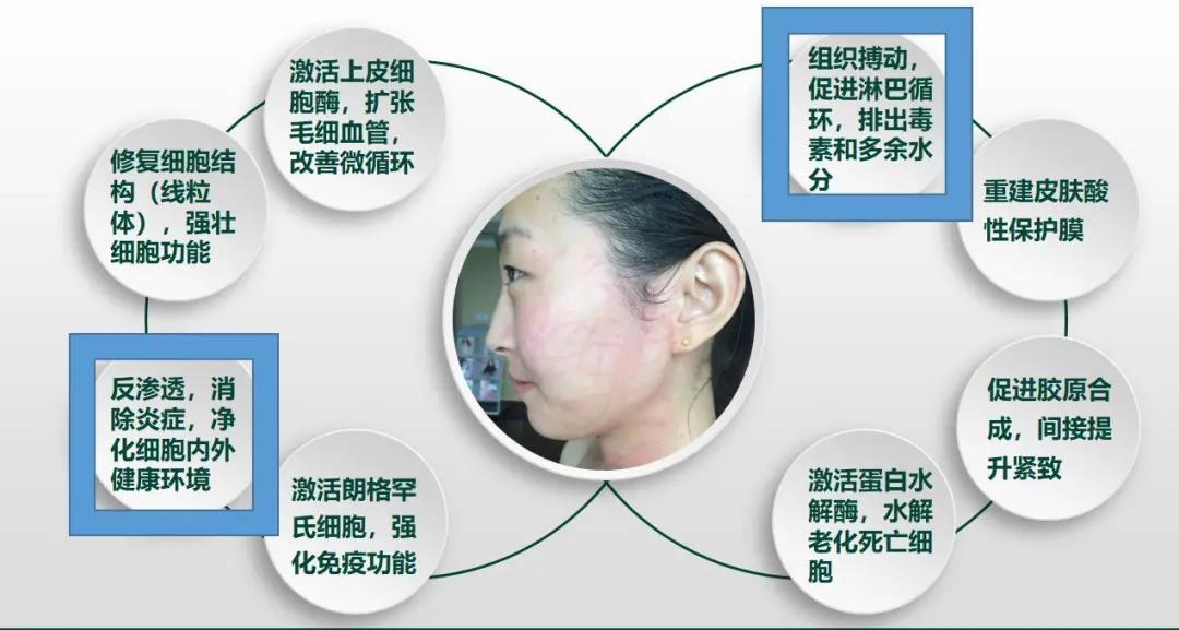 dmk生物酶疗效果怎么样,DMK生物酶疗会出现什么效应