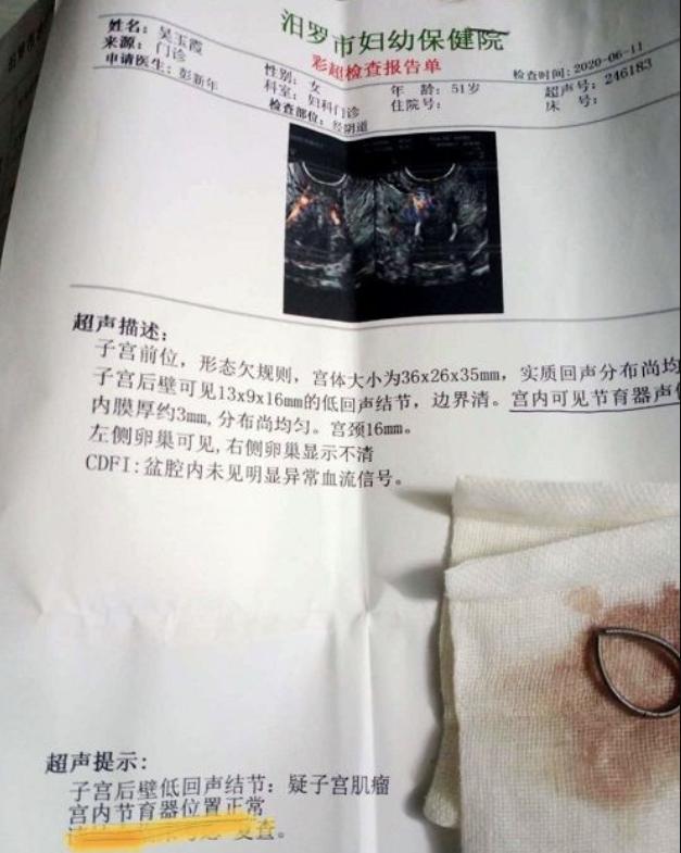 节育环取环后会出现什么现象,带环16年取环后不孕的原因