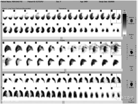 颈肩痛用针刺疗法效果好吗,颈肩腰腿疼儿童疾病