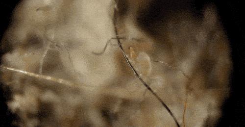 人人都会长黑头吗,好多人都长黑头吗