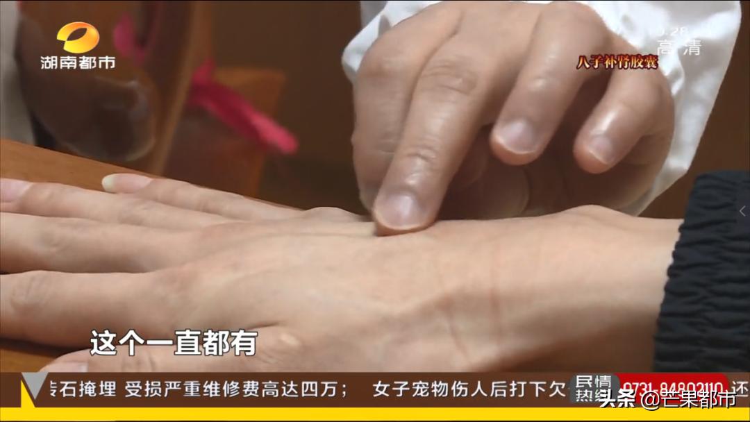 身上长这3种痣要警惕,身体上有这种痣要当心