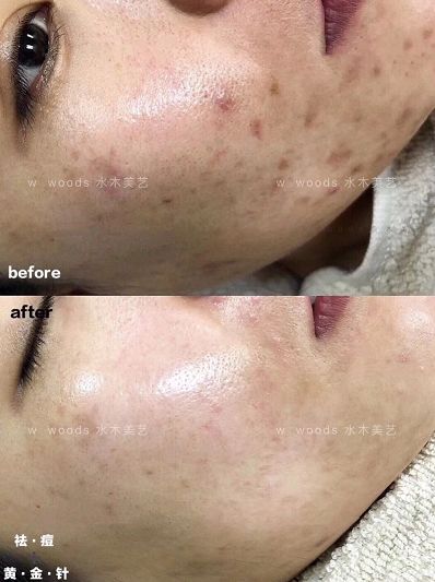 火遍银座的日本殿堂级护理AXXZIAPOLA来宜兴啦!