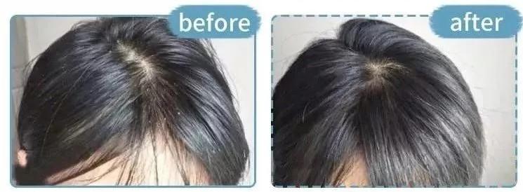 宋慧乔短发上热搜了,2020最火宋慧乔海藻卷