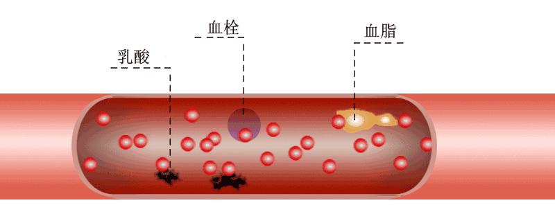 人过了50岁以上为什么精神就不行,人过50岁后脑筋不好是什么原因