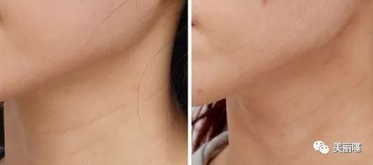 微商的大牌化妆品为什么那么便宜,微商卖的大牌化妆品为什么便宜