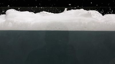 上厕所被水花溅到怎么处理,小便时被马桶水溅到了怎么处理