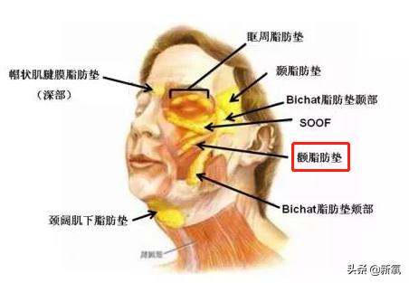 戴牙套真的会出现牙套脸,戴牙套期间牙齿变龅了