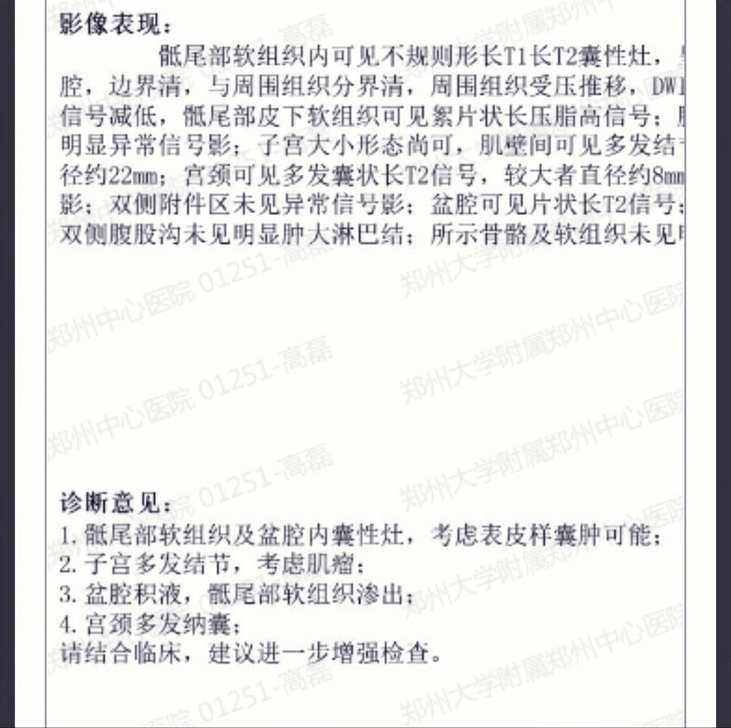 让我虚惊一场的骶前巨大囊肿