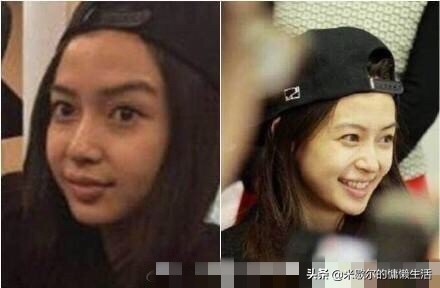 angelababy眼睛整过吗,angelababy有没有整过脸