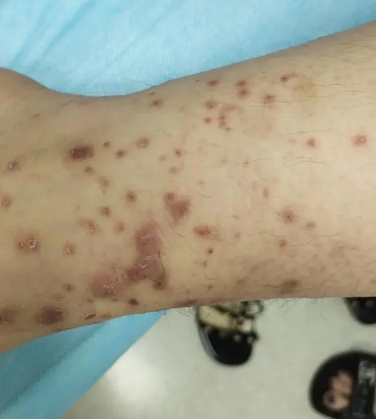 鍗庤タ鐨偆绉戞潕钀岃悓,鍗庤タ鍖婚櫌鐨偆绉戝尰鐢熸潕钀岃悓