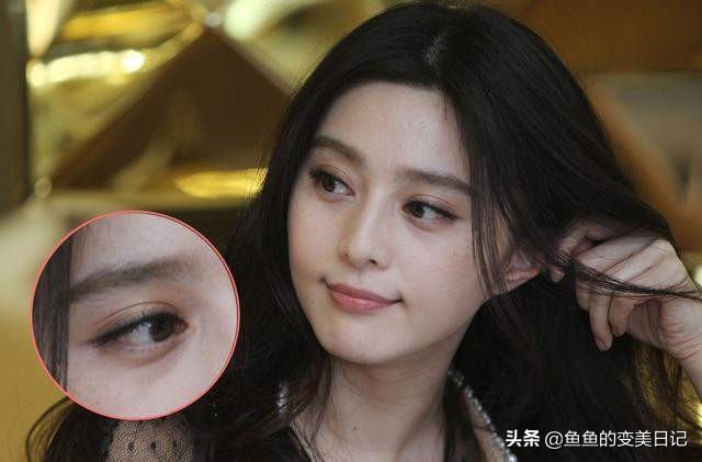 双眼皮知识点总结大全,关于双眼皮的十大真相