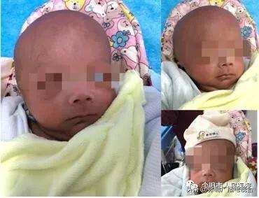 600克袖珍婴儿出院,860克早产女婴