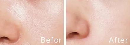 好皮肤怎么样养成的,好脸蛋