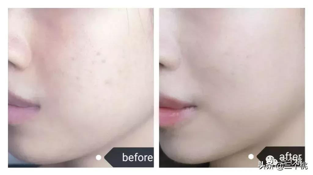 十大公认好用的粉底液评测,十大口碑最好的粉底液夏天