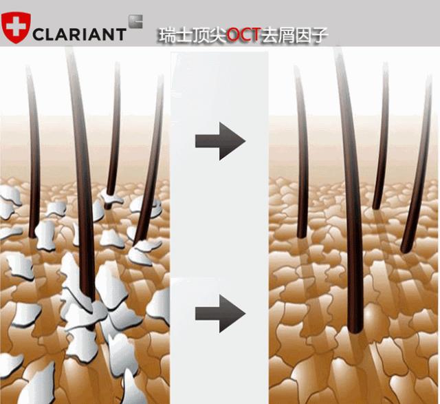 挑战3天不洗头依然干爽不油腻,4天不洗头头发就油了正常吗