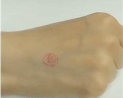 皮肤痒擦炉甘石有用吗,脸红肿痒涂抹炉甘石管用吗