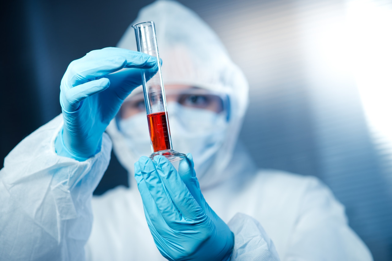 toll是什么意思呀,toll是啥表