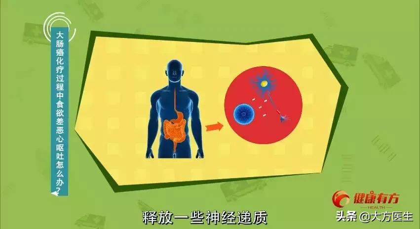 大肠癌化疗怎么做,清风计划战胜癌症