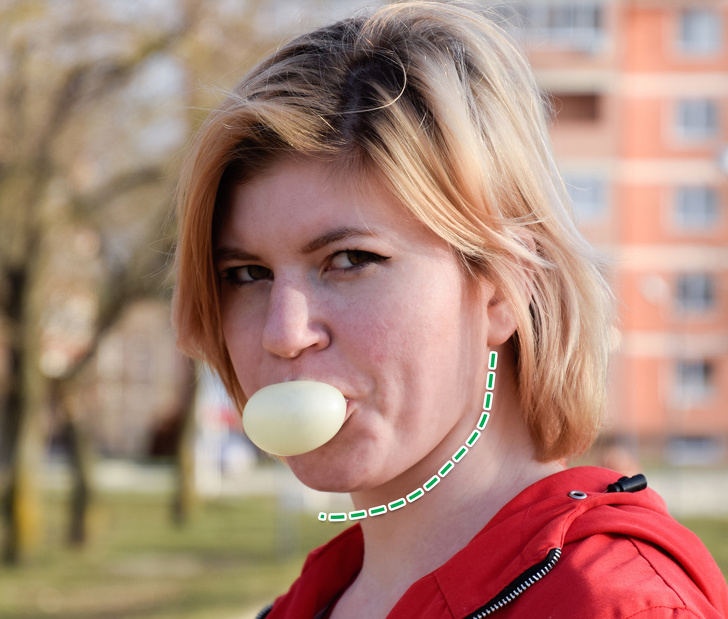 减少面部赘肉,减少面部双颊脂肪的医美项目