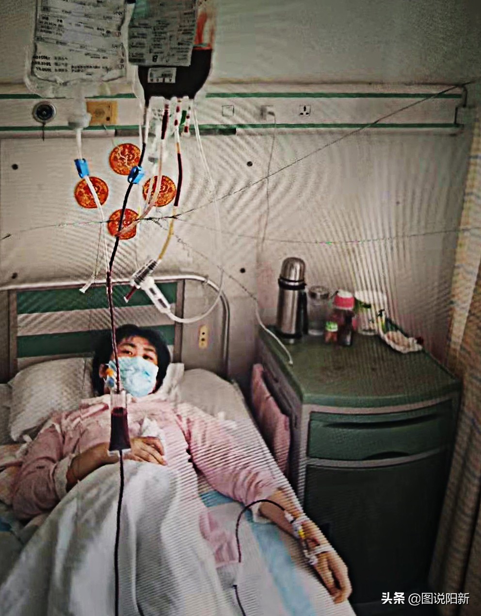 17岁女孩捐赠器官前被救,女孩捐献器官协议书