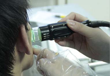 治疗白癜风哪种光疗效果好,白癜风光疗副作用是什么