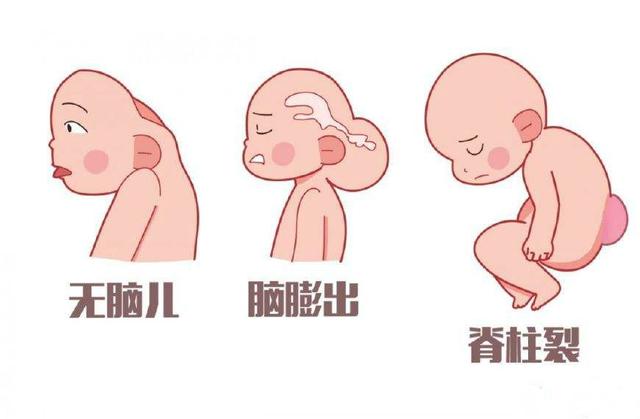 备孕科学补叶酸健康好孕有保障,备孕补充叶酸的好处是什么呢