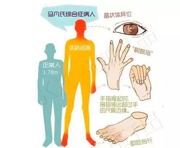 什么原因主动脉血管夹层破裂,主动脉夹层血管破裂应该注意什么