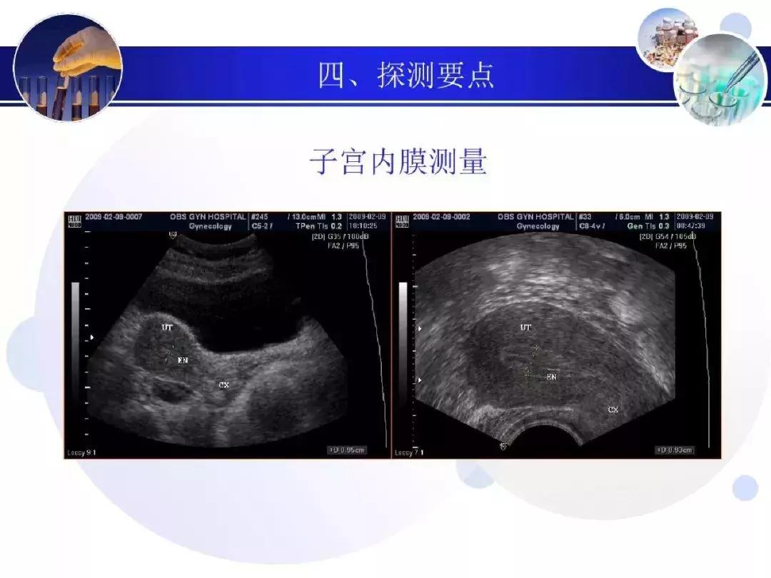 纯干货！子宫及附件解剖和超声诊断