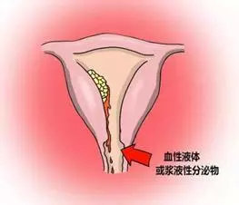 全国肿瘤防治宣传周向女性朋友们的忠告——如何预防妇科肿瘤