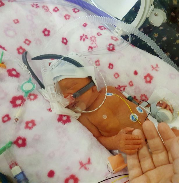 英国孕妇怀孕三胞胎,美国妈妈怀孕羊水破了