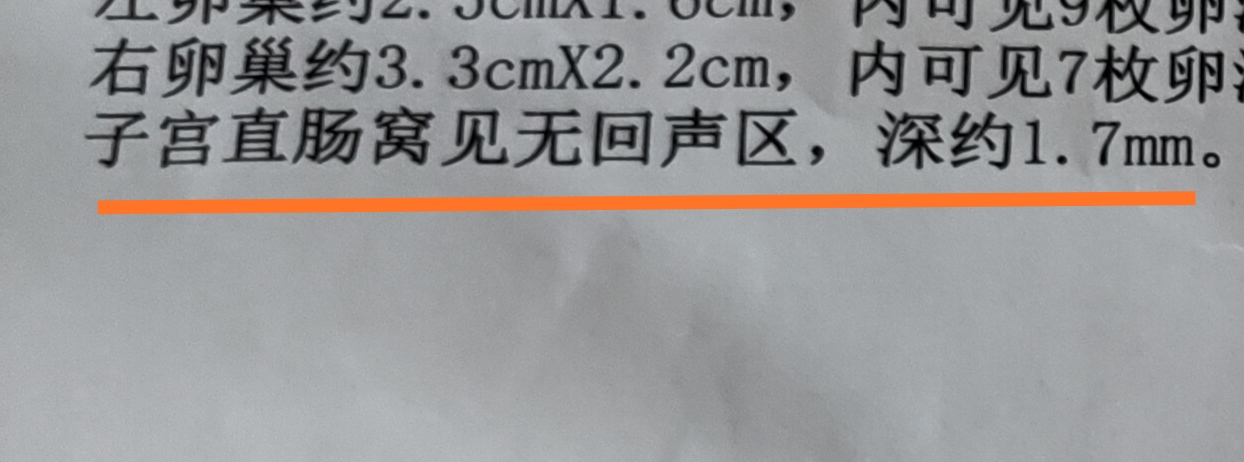那些你以为很严重的病,有哪些妇科病是不需要治疗的