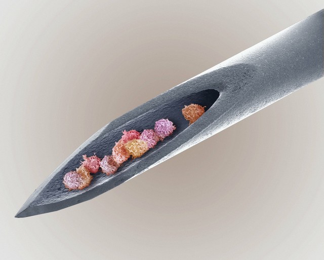 医美维权新途径:投诉医美机构欺诈,诉求退一赔三