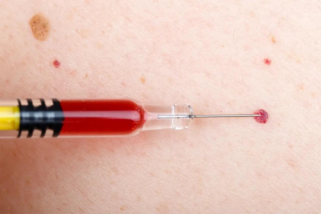 身上突然起小红点需要看医生吗,身上长了密密麻麻的小红点是什么