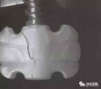 木吉他常见问题,木吉他瑕疵怎样修理