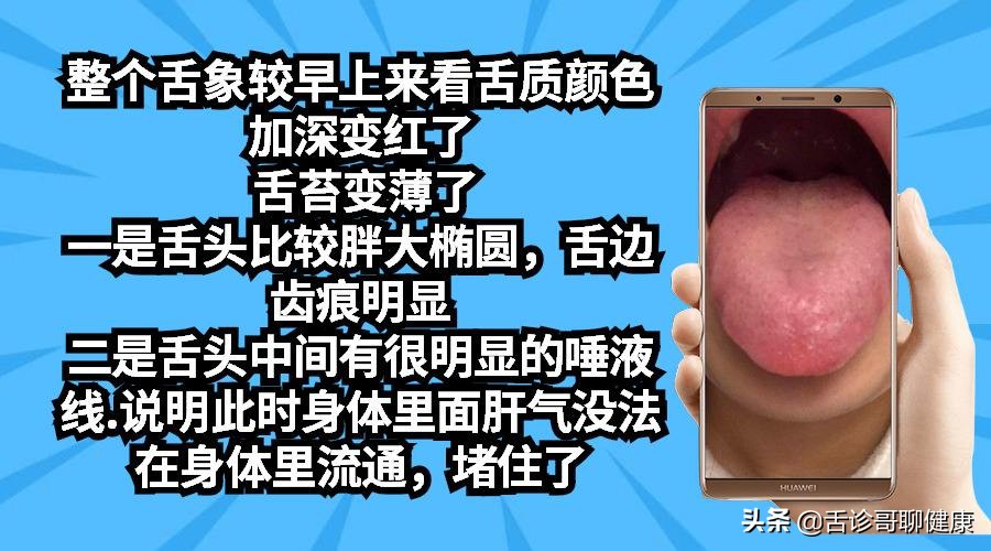 舌诊哥聊血瘀,舌诊哥聊健康痰湿