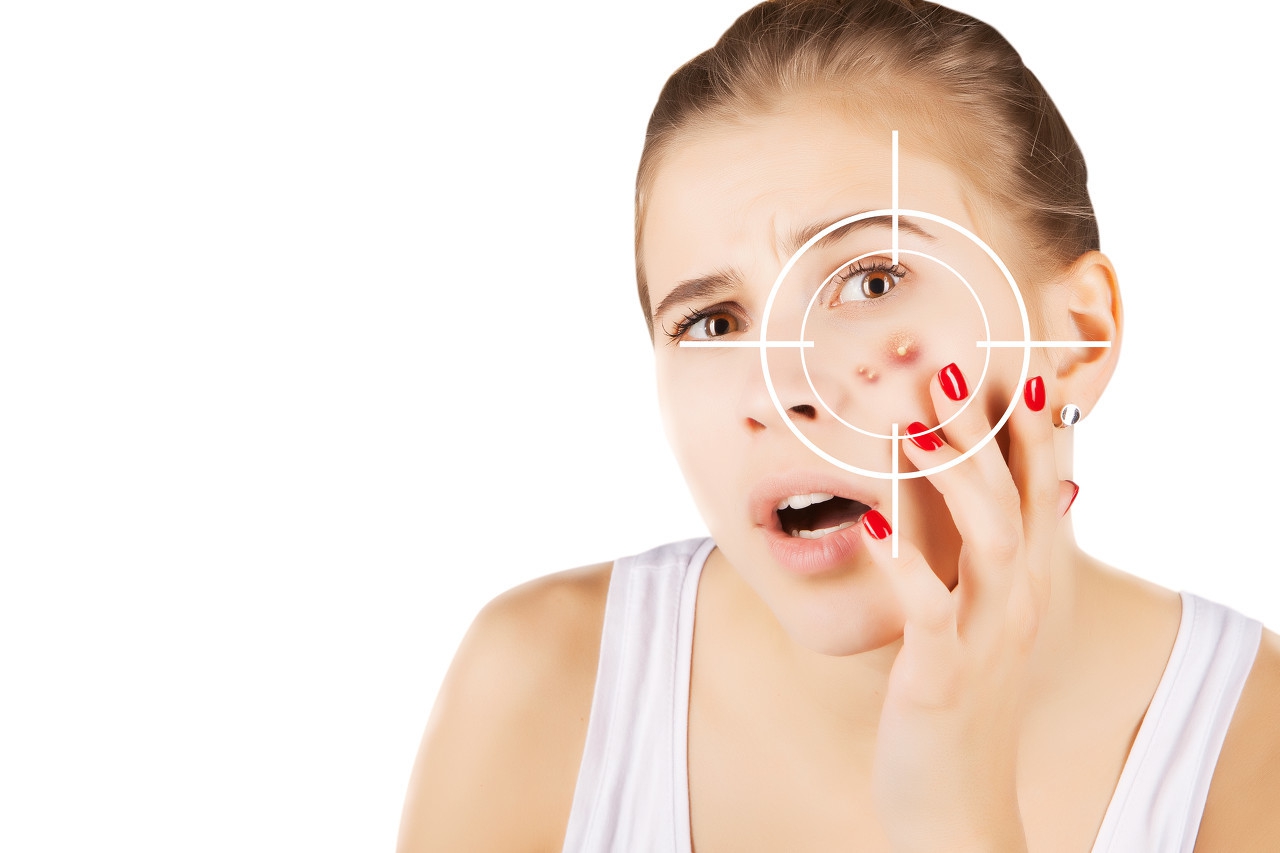 毛囊炎起的痘痘有凹陷吗,痘痘和痤疮怎么区分