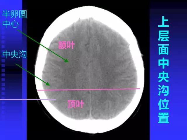 头颅mri读片视频教程,颅脑mri读片入门教程视频讲解全集