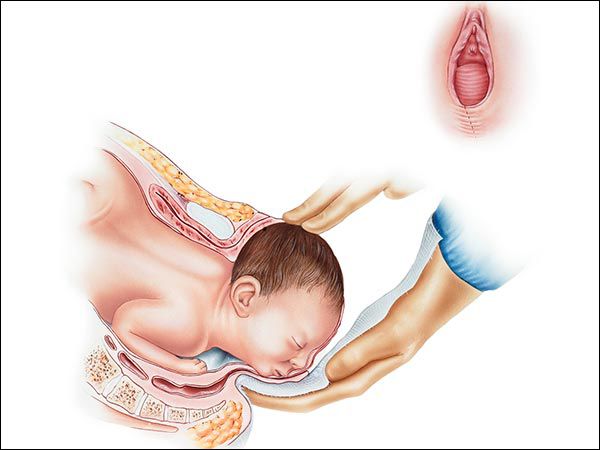 产后60天漏尿腹直肌分离怎么改善,产后如何防止子宫下垂腹直肌分离