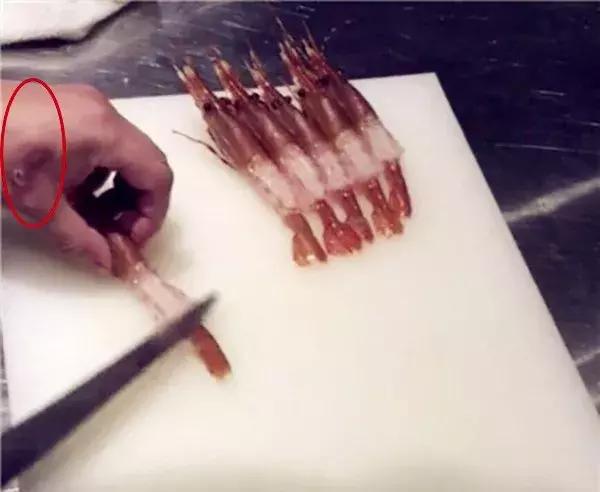 厨师手上有疮,日料店厨师手上有疮