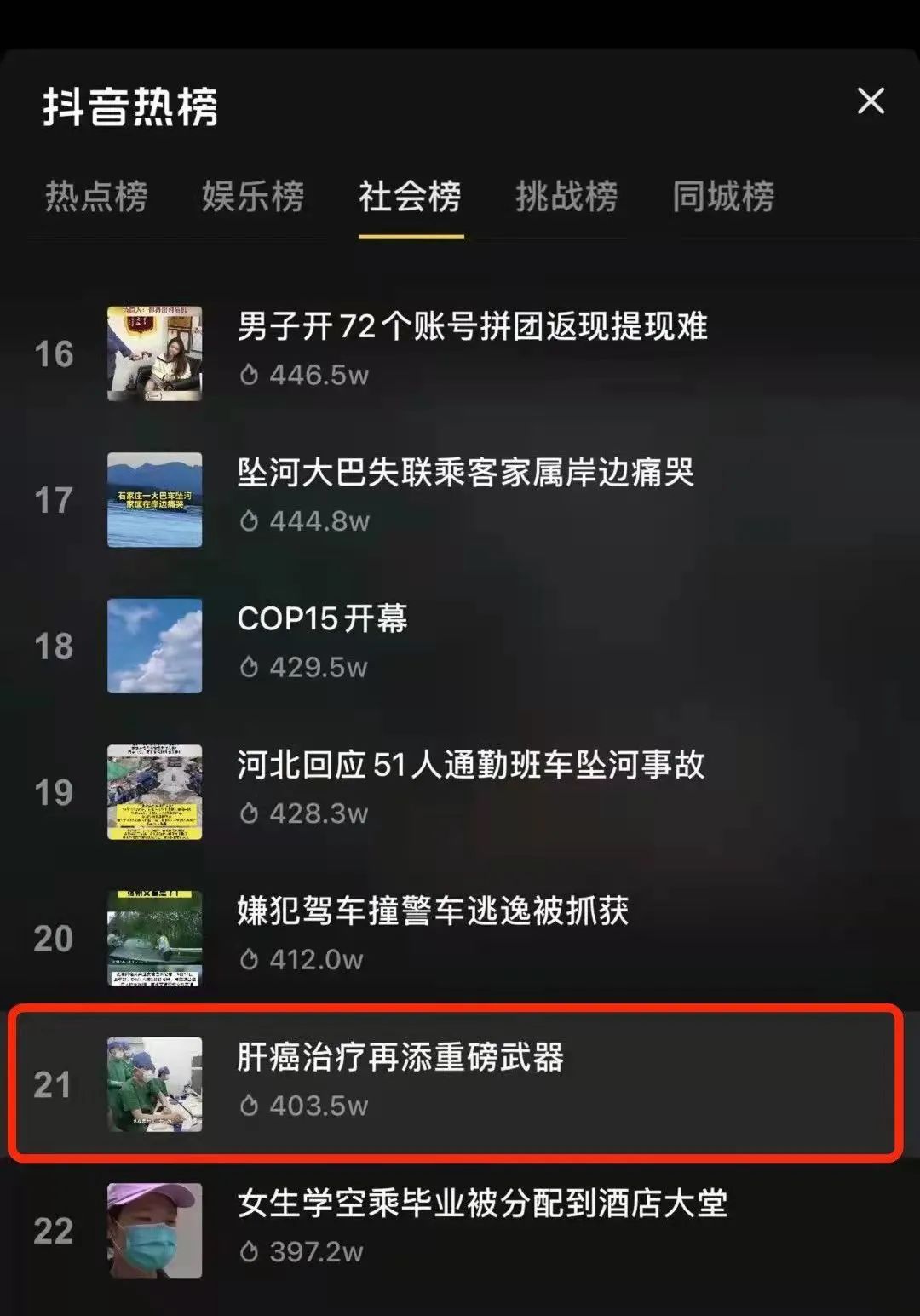 中国首例肝癌已手术,一台一百多亿的治疗癌症机器