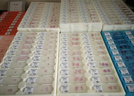 组织切片常见问题,组织切片的制作过程以及常见问题