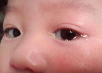 钧钧妈分享:新生儿吐奶、打嗝、腹胀、黄疸……,怎么办?