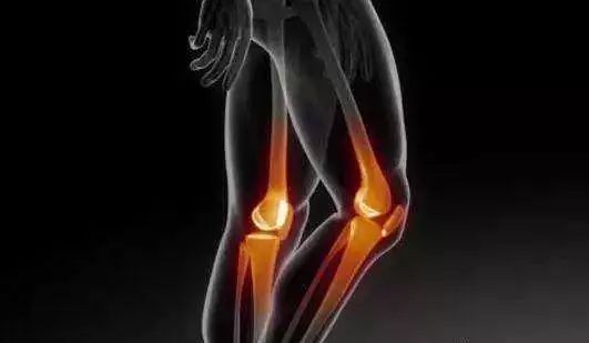 根治膝关节炎的特效药,我不是药神强直性脊柱炎